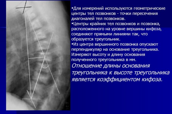 Что такое кракен тор